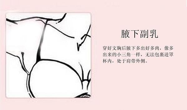 怎么判断副乳的类型