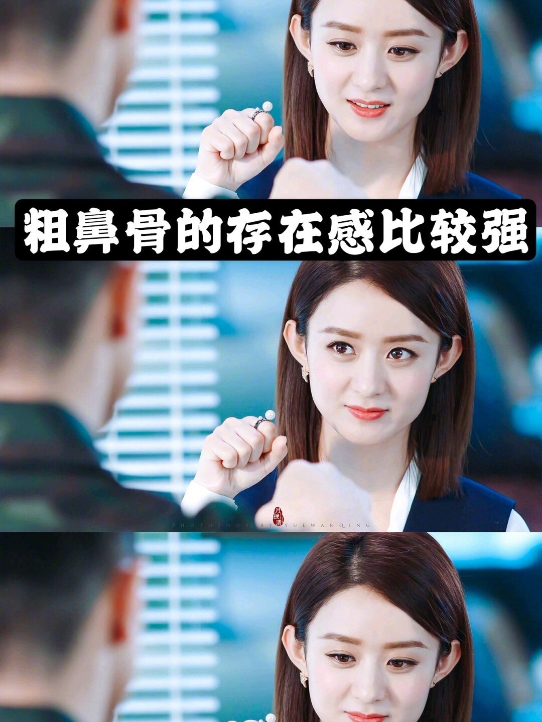 要不要做鼻骨内推?你适合做吗?