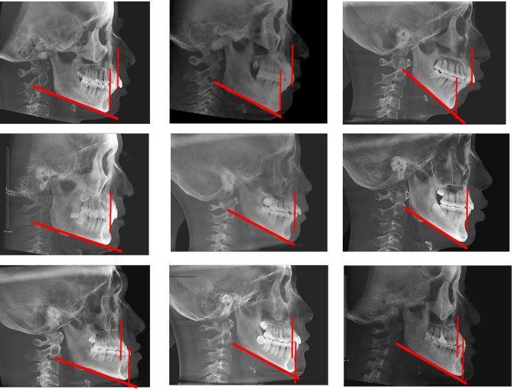 痒痒看过来卑微女孩求改造求看脸变好看
