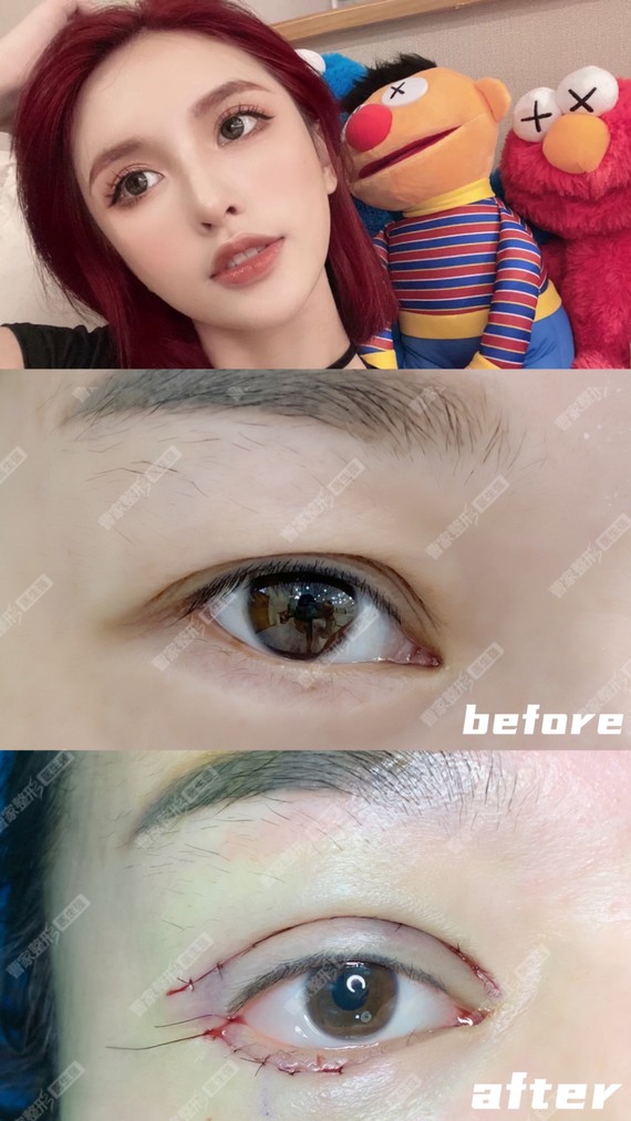 圈子-新氧美容整形