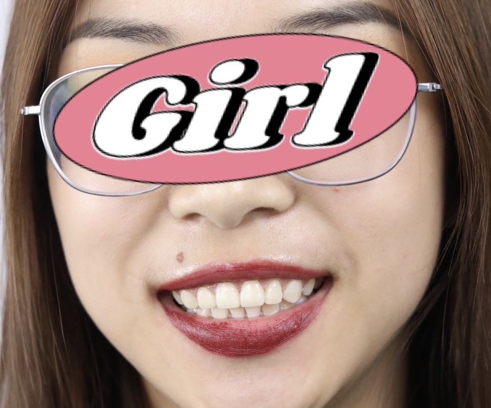 蝴蝶牙修复整齐效果好好啊