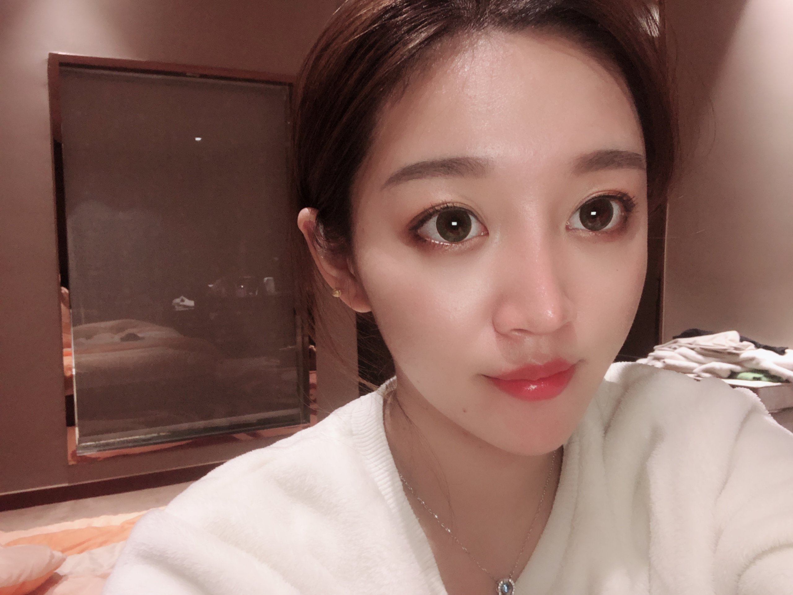朝天鼻该怎么办?_新氧-专业医美服务平台