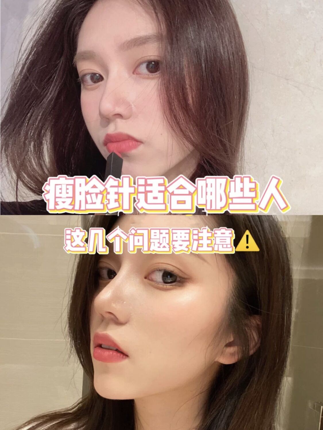 那些不适合打瘦脸针的人 1颧骨高,下颌角明显的患者:咬肌萎缩后,颧骨