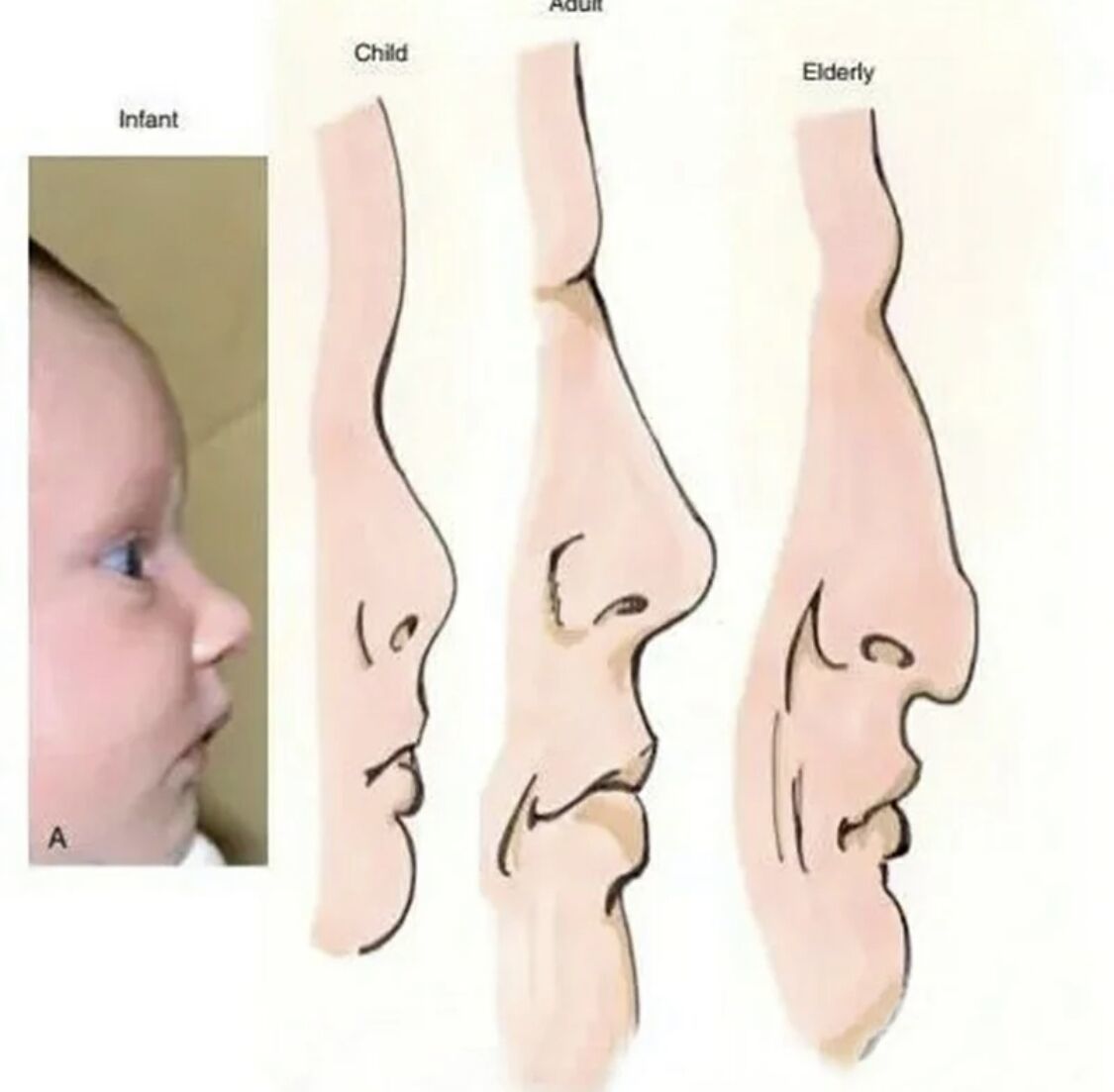 鼻子从小到大变化图图片