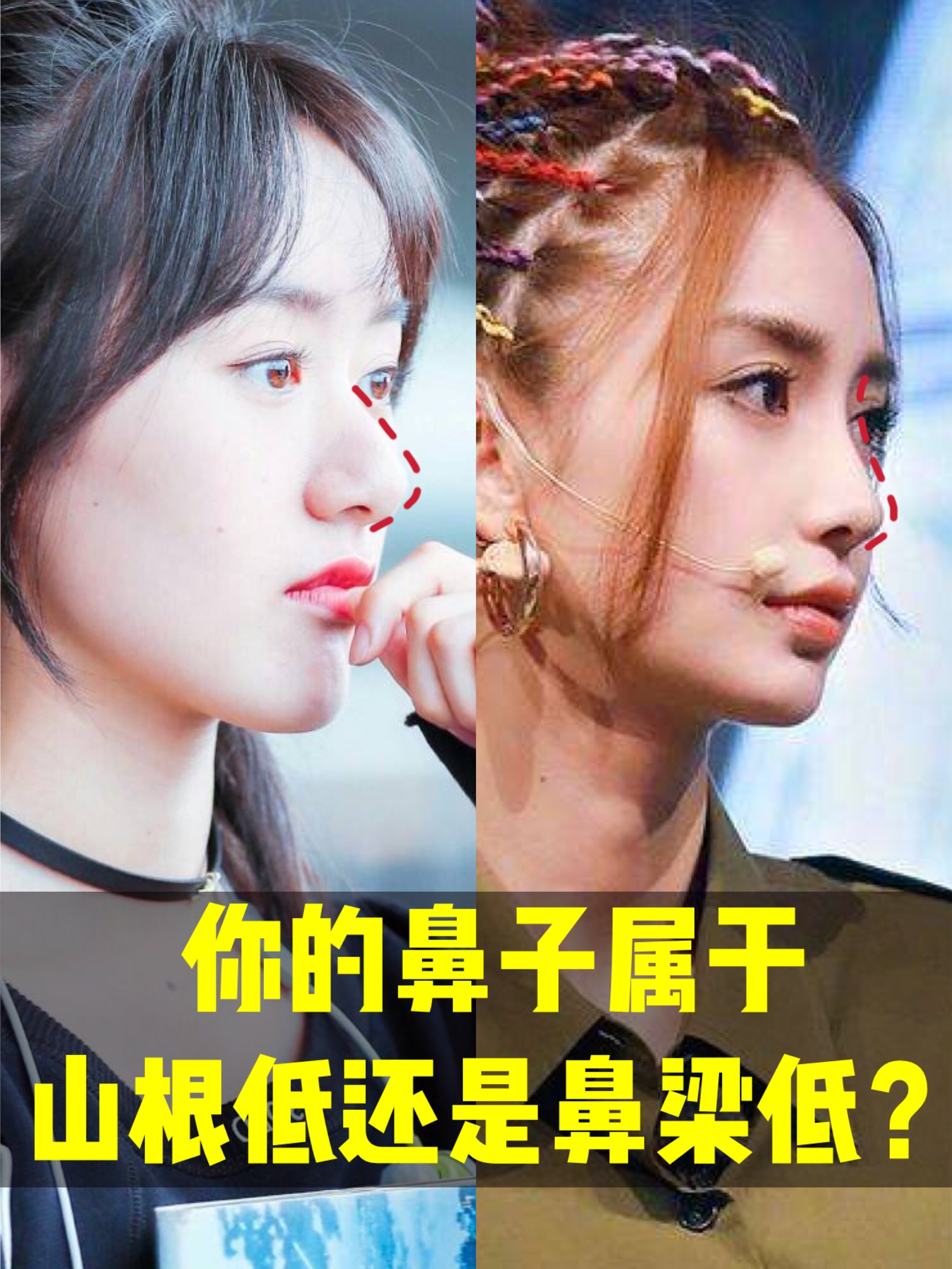 你的鼻子属于山根低还是鼻梁低 如果把鼻子比喻成面部 圈子 新氧美容整形