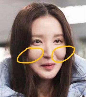 嬉笑间两坨苹果肌过度的隆起