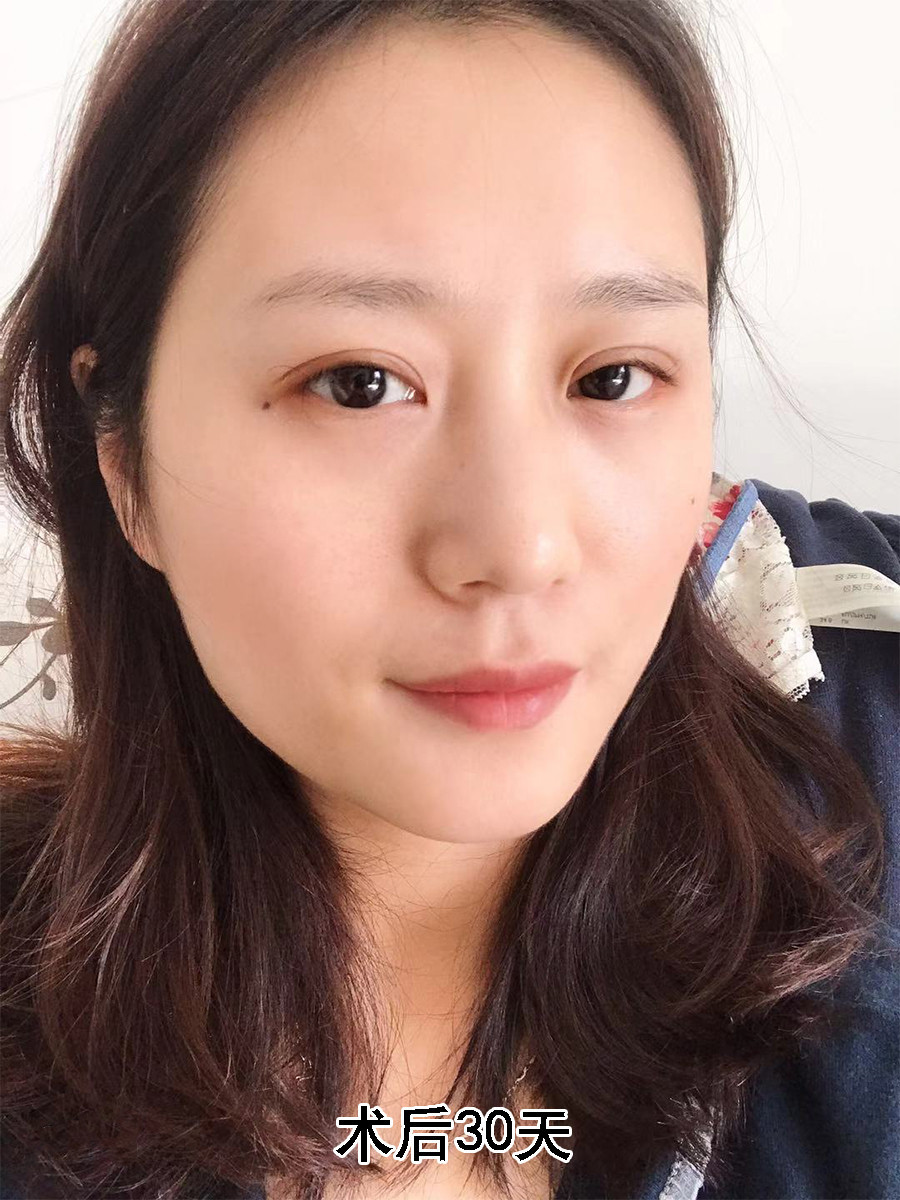 自然妈生款双眼皮太好看了吧!