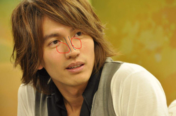 关于鼻骨宽的形成原因和两种解决方式羊交代完了,整