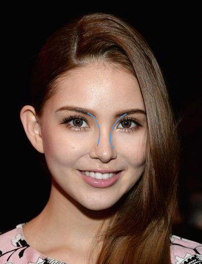 审美分析影响五官的短板鼻骨宽如何解决