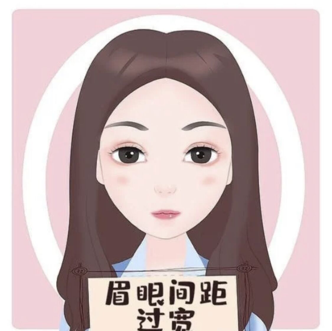 武汉美基元眼间距过宽矫正