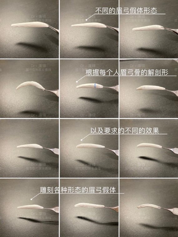 眉弓是侧颜天花板?还能拯救眼球突出?