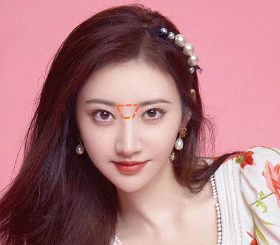 做了妈生鼻也显假只因忽略了这一个细节