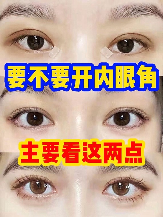 90%的人都不知道,内眼角开不开要看这两个地方