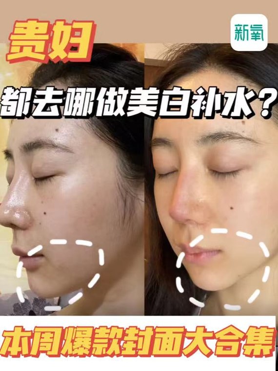 首页 此页面仅支持预览 Avatar 新氧榜姐 139篇日记 上周点击量3000 的爆款日记 封面图有哪些特点 哈喽大家好 这里是你们的榜姐 告诉大家一个小秘密 一个好的封面 更能使日记内容的点击量up Up Up哦 当你加入了创作激励计划 日记获得的