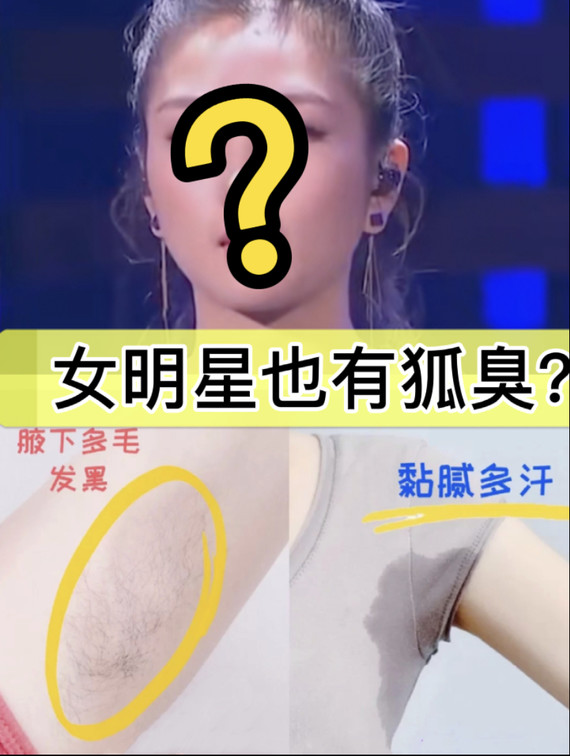 夏天狐臭有多尴尬狐臭腋臭该如何根治