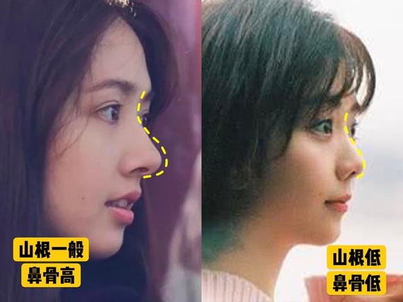为什么做完鼻子不好看 问题出在这里 Hello朋友 圈子 新氧美容整形