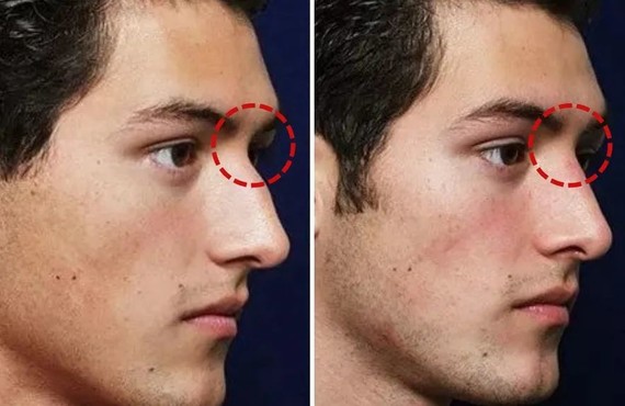 搭配她们"额头高,眉骨高,眼窝深,眼皮脂肪少,颧骨高"的骨骼和皮相来说