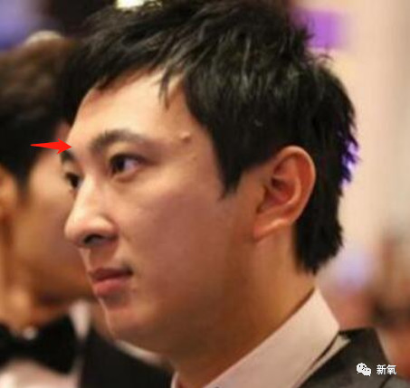 大家可以自测,微微抬起下巴,额头就会向后倾斜这是必然的,虽然这只是