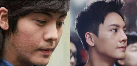 比如大帅比陈伟霆,脸蛋光不光滑真的判若两人.