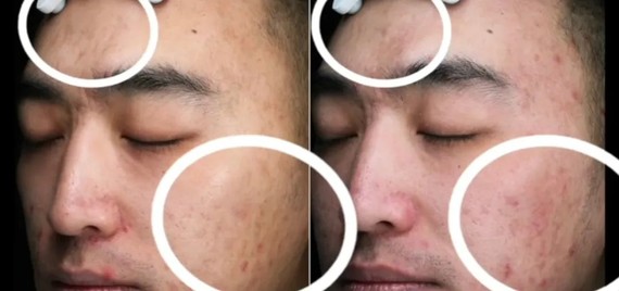 丑了13年的月球表面脸是如何在3个月内逆袭的