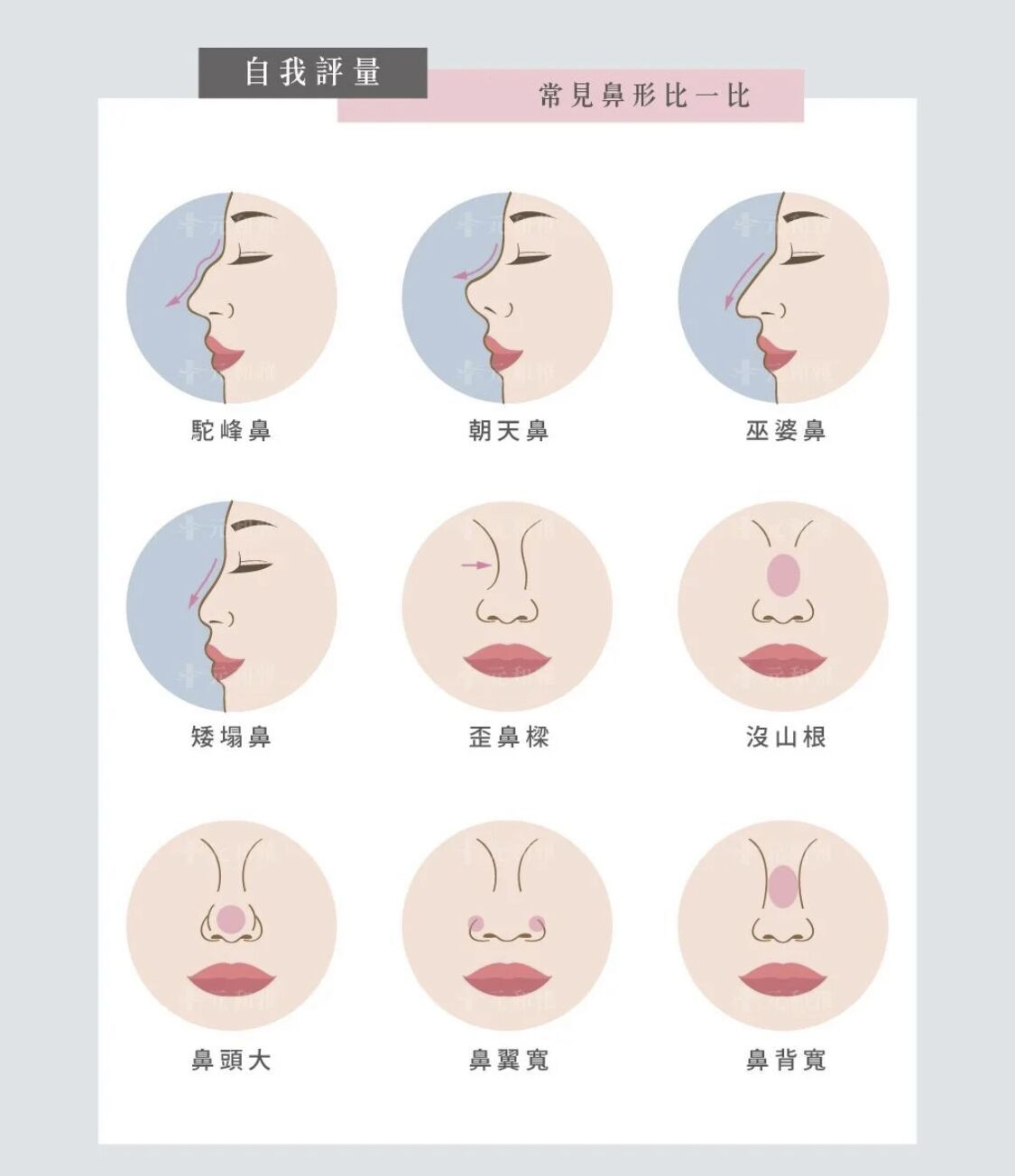女生鼻型分类图解图片