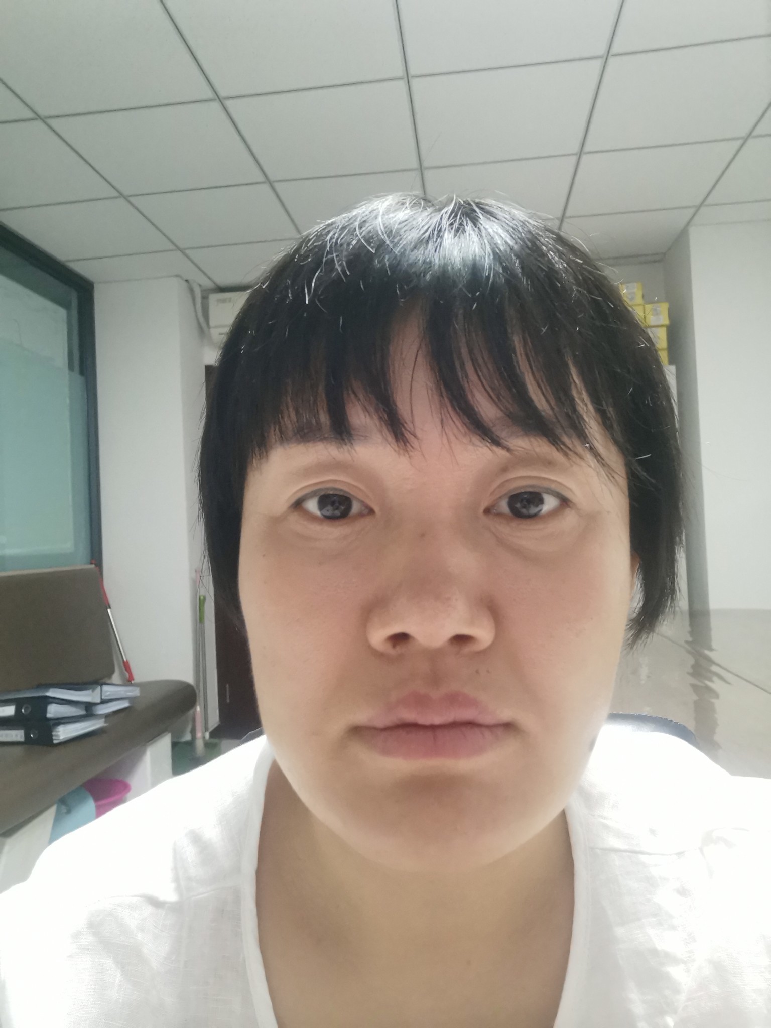 我想改善的部位:眼部改善需求:眼袋厉害,眼角下垂,_圈子-新氧美容整形
