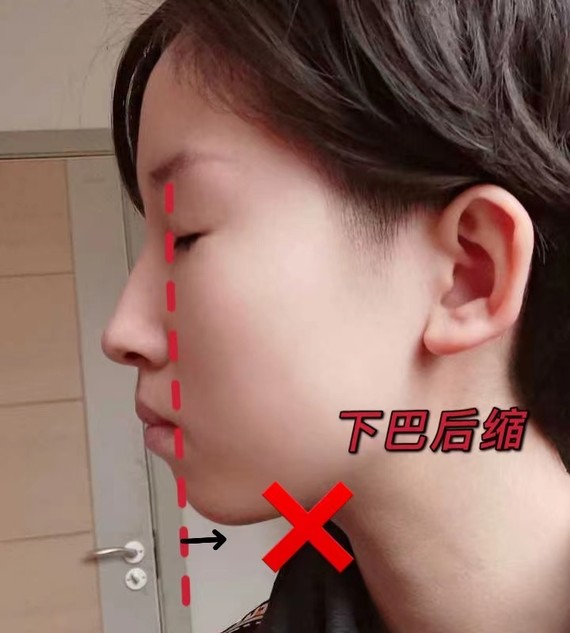 测一测你的下巴符合好看的标准吗