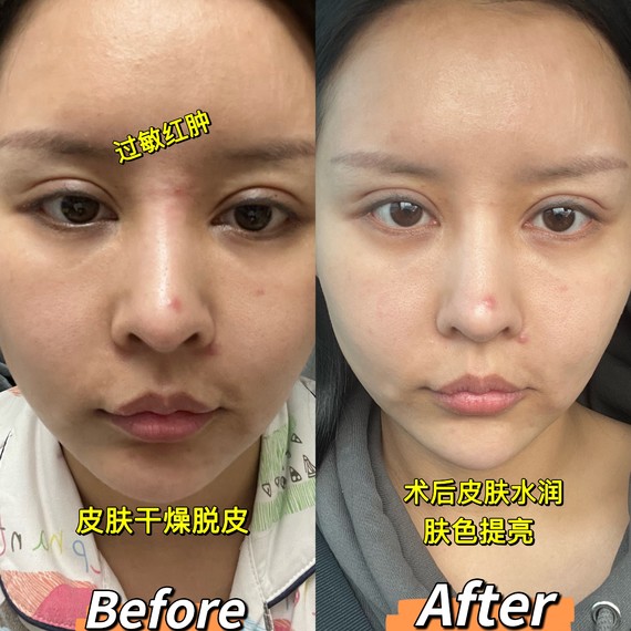 半岛舒敏专家评测|敏感肌的"灭火器",一定要试试它_圈子-新氧美容整形