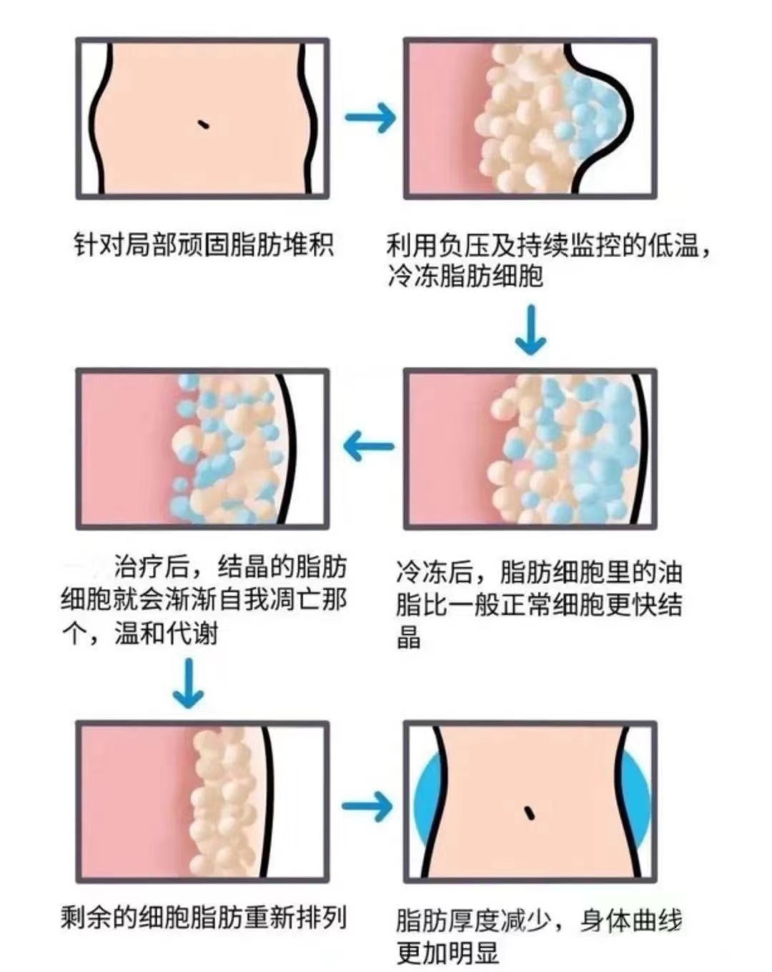 合规利剑不断逼近，医美行业规范化势在必行