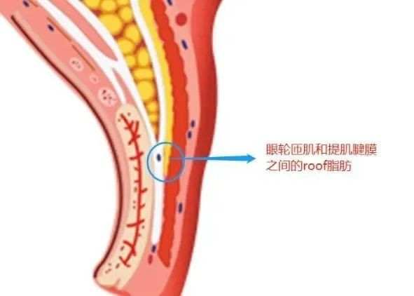 何航远：如何做出一双弧度流畅的双眼皮丨专业视点