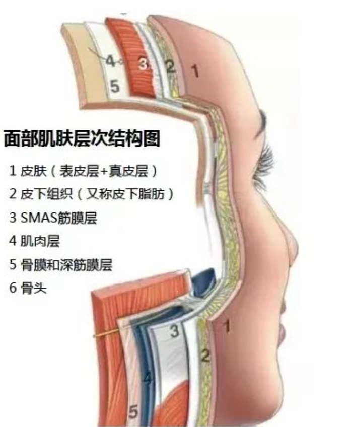 抗衰的天花板是分层抗衰？Fotona 4D比热玛吉、超声刀、超声炮效果更好？