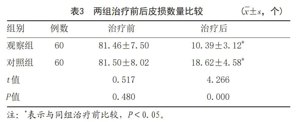 皮肤美容 |二甲双胍联合艾拉-光动力疗法治疗面部中重度痤疮临床评价