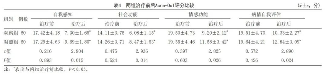 皮肤美容 |二甲双胍联合艾拉-光动力疗法治疗面部中重度痤疮临床评价