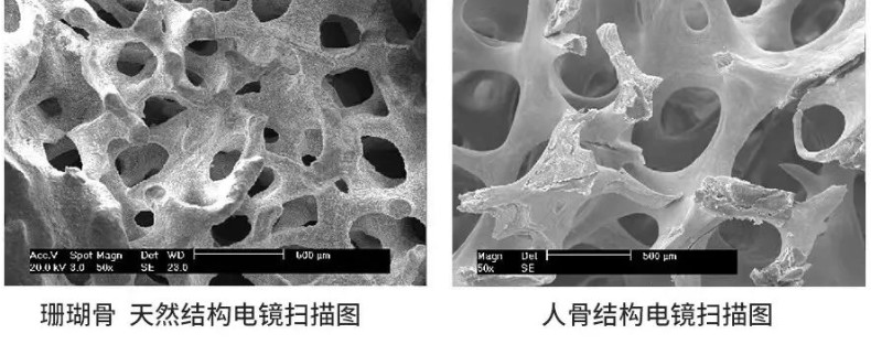 骨整形浪潮 卡洛尔邦珊瑚骨领启骨再生领域新增长