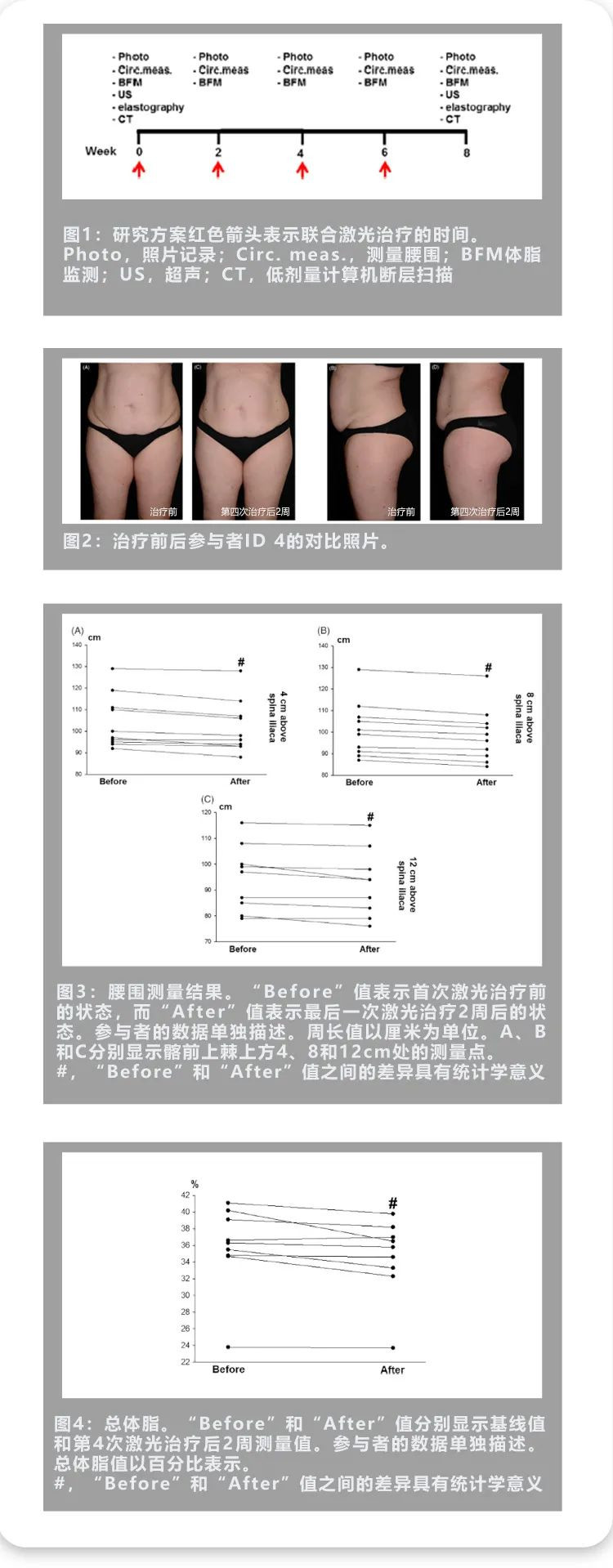 长脉冲1064nm和2940nm激光在无创溶脂和皮肤紧致中的有效性和安全性