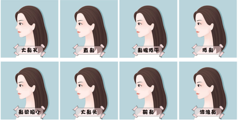 张明欣：双侧耳软骨在鼻支架中的应用丨专业视点