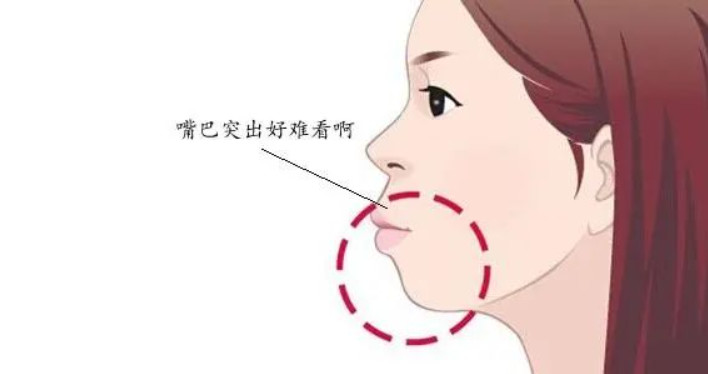 鼻基底整形的方法有哪些？丨科普篇