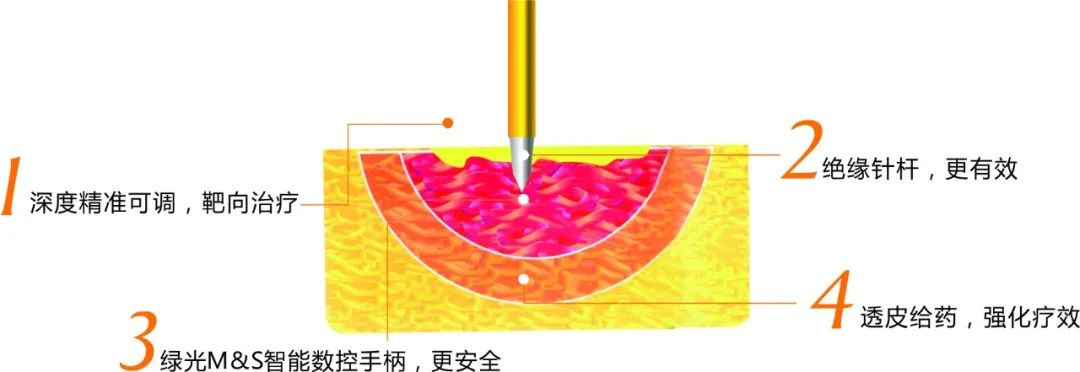 周杰伦发新歌了，你的青春回来了吗？