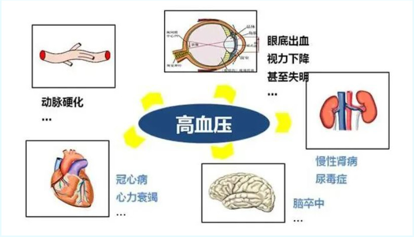 高血压患者做整形手术需要注意什么？