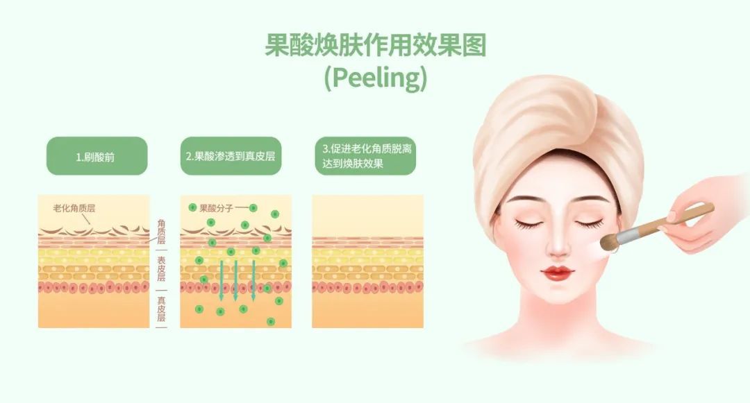 解决毛孔粗大推荐光子嫩肤+果酸治疗的王炸组合!还可试试这些方法